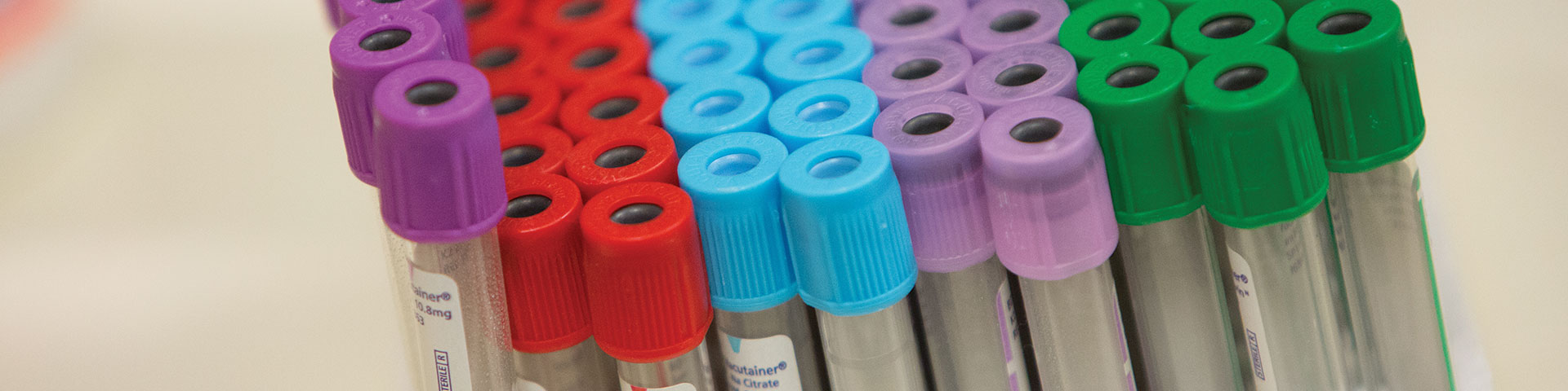 Photo of vials